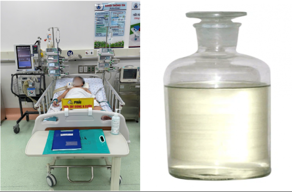 Hít phải hóa chất hàn nhựa để trong ô tô, bé trai hôn mê Hít phải hóa chất hàn nhựa để trong ô tô, bé trai hôn mê