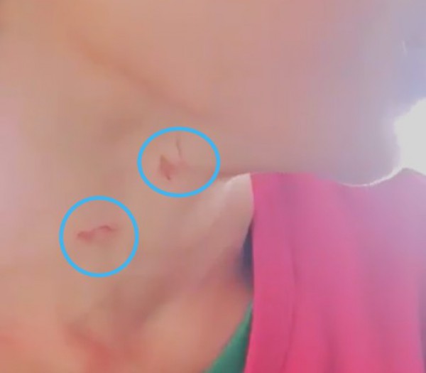 Hỗ trợ bé trai bị cha dượng bạo hành, gây tổn thương vùng kín Hỗ trợ bé trai bị cha dượng bạo hành, gây tổn thương vùng kín