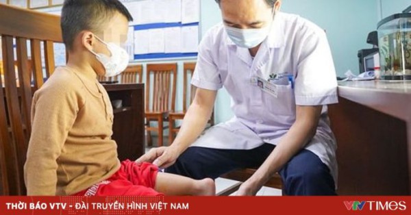 Xoay cẳng chân 180 độ tạo khớp gối mới cho bé trai 5 tuổi