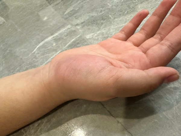 Xác minh vụ giáo viên dùng thước đánh học sinh tiểu học 