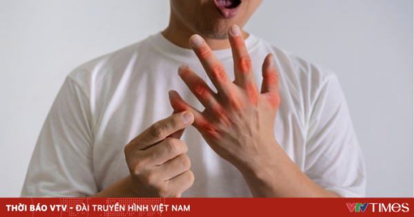 3 bệnh lý chuyển hóa thường gặp sau Tết