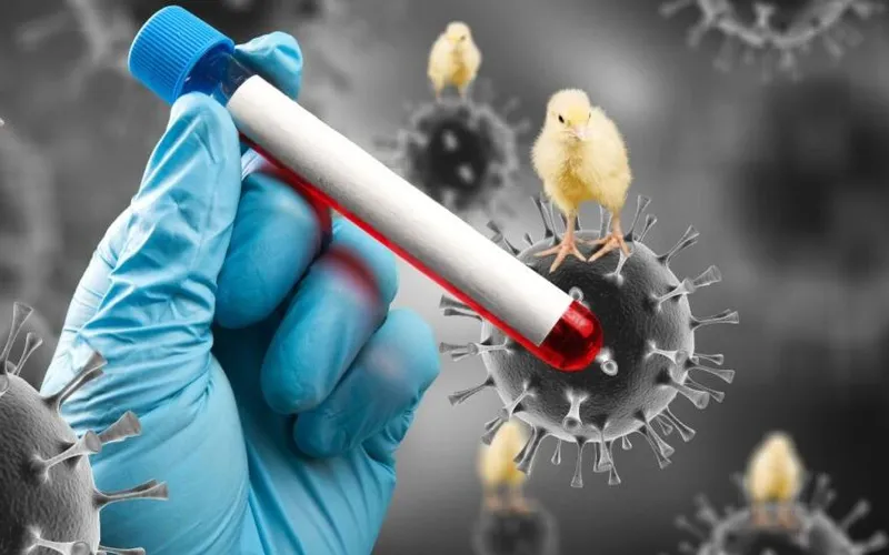 Bé gái viêm não do virus cúm gia cầm H5N1