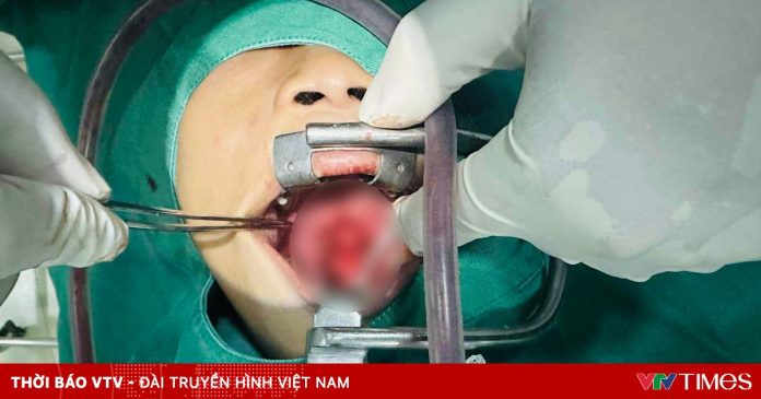 Bé trai 9 tuổi bị que nứa đâm rách khẩu cái khi chơi đùa
