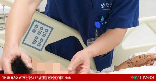 Bé trai 9 tuổi nguy kịch do kíp nổ tự chế