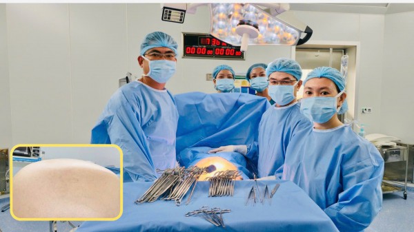 Khối u buồng trứng hơn 20 kg nhưng tưởng tăng cân