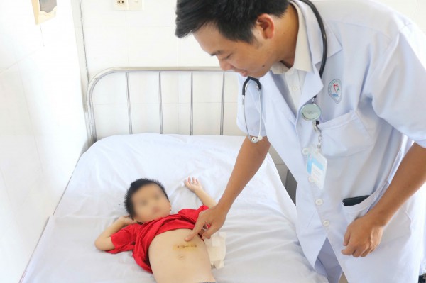 Lấy búi tóc nặng 0,5 kg trong dạ dày bệnh nhi Lấy búi tóc nặng 0,5 kg trong dạ dày bệnh nhi