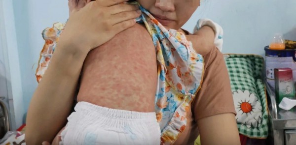 Năm 2025, ngành y tế TP.HCM đã làm được gì?