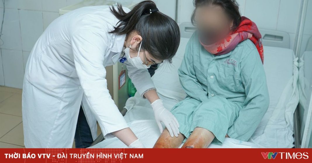 Ngâm chân giữ ấm bằng bột lá, người phụ nữ bị hoại tử hai bàn chân nghiêm trọng