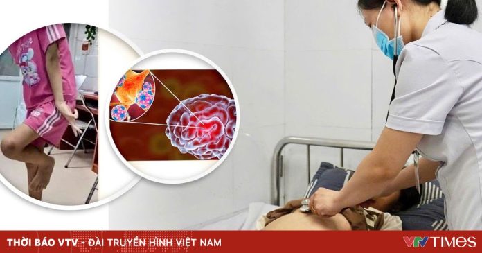 Phát hiện sớm viêm não tự miễn, bé gái 12 tuổi hồi phục sau 9 ngày điều trị