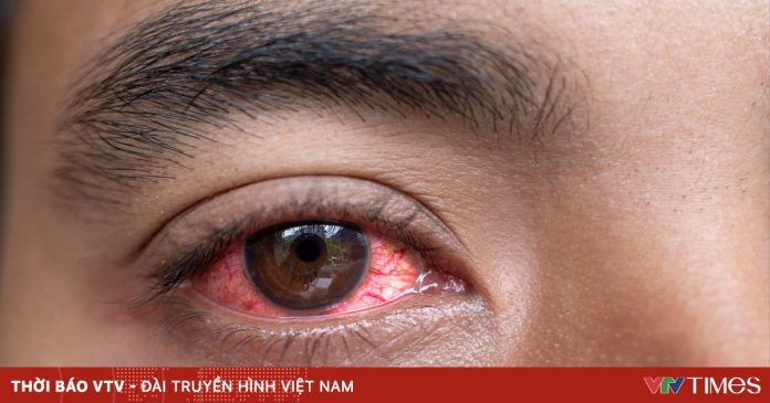 Phòng chống các bệnh thường gặp trong lũ lụt