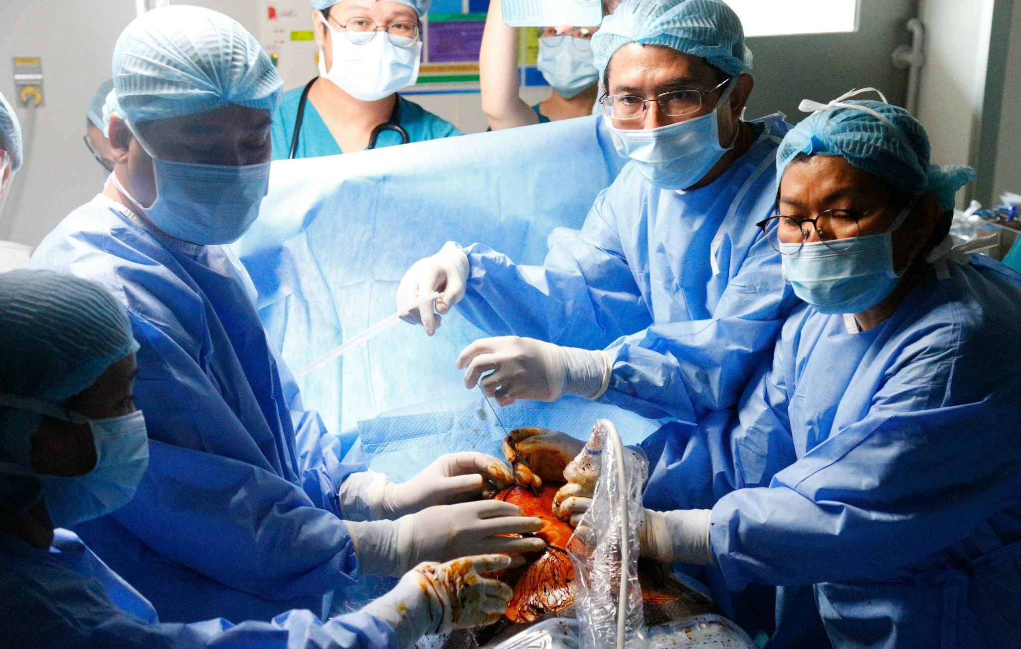 Y tế hiện đại: Kỹ thuật thông tim bào thai tinh tế