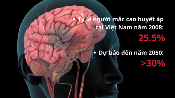 Ẩn họa tăng huyết áp ở người trẻ