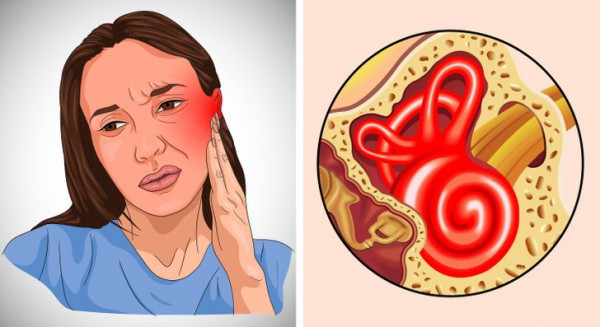 6 dấu hiệu giúp bạn nhận biết đã bị nhiễm trùng tai