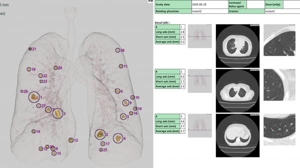 Chỉ chậm 2 tháng, ung thư đã hình thành: Tầm soát sớm và định kỳ thế nào?