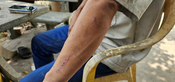 Chủ gara ở Củ Chi tố bị hàng xóm hành hung sau khi hỏi tiền sửa xe