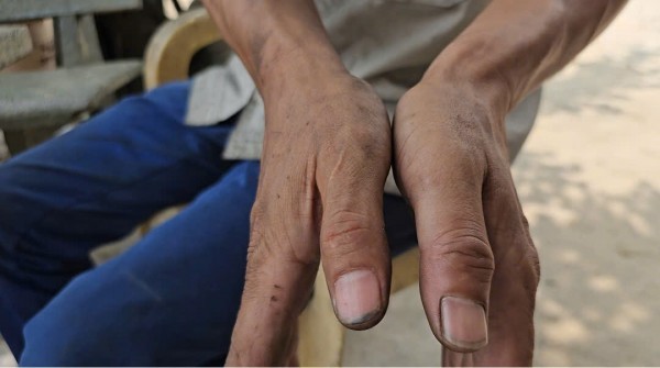 Chủ gara ở Củ Chi tố bị hàng xóm hành hung sau khi hỏi tiền sửa xe