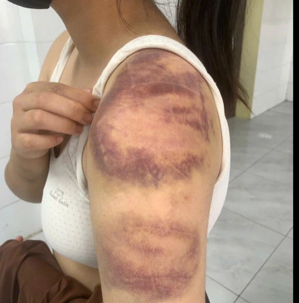 Khởi tố đối tượng trói, đánh con ruột, hành hạ vợ mang thai