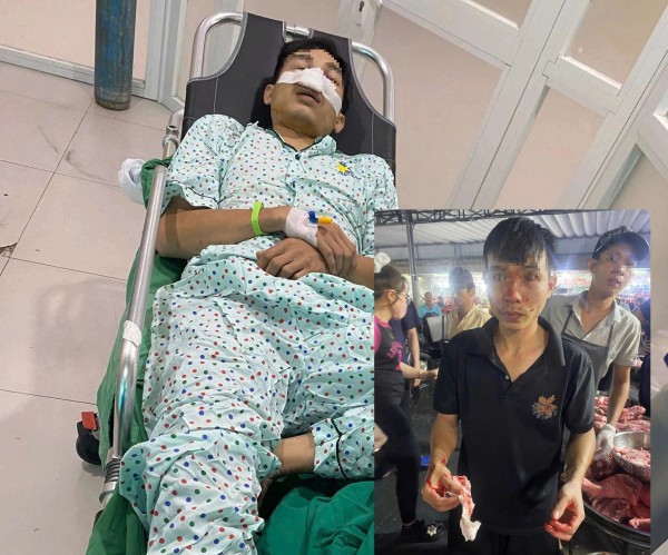 Người đàn ông bị đánh ở chợ đầu mối Hóc Môn phải nhập viện
