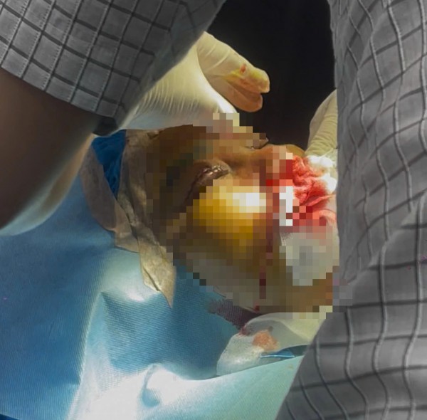 Phường Gò Vấp siết thẩm mỹ 