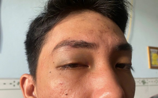 Tài xế ô tô bị hành hung vì quay phim xe tải chắn lối đi Tài xế ô tô bị hành hung vì quay phim xe tải chắn lối đi