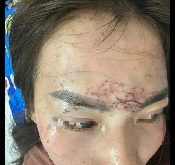 Vụ đánh ghen xăm mặt ở Cà Mau: Đề nghị truy tố 2 bị can