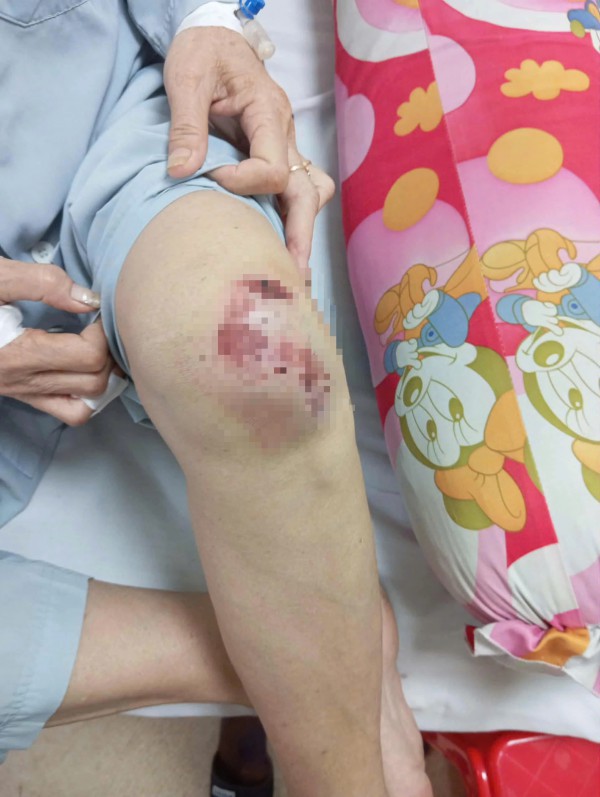 Điều tra vụ người phụ nữ bị con riêng của ba chồng dùng dao tấn công