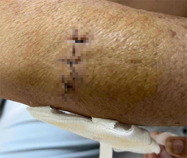 Điều tra vụ người phụ nữ bị con riêng của ba chồng dùng dao tấn công