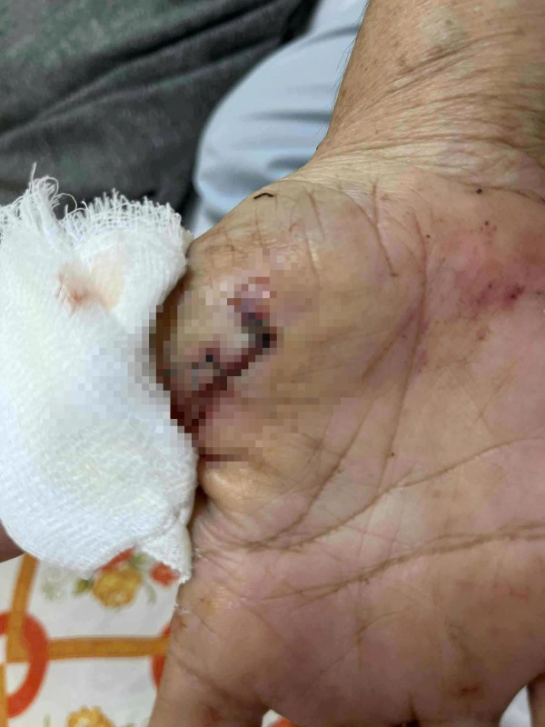 Điều tra vụ người phụ nữ bị con riêng của ba chồng dùng dao tấn công