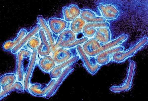 Ethiopia bùng phát virus Marburg, tỷ lệ tử vong cao ngang Ebola