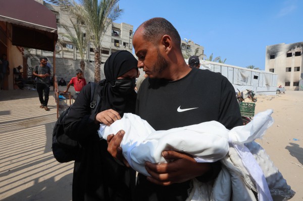 Tình trạng suy dinh dưỡng ở Gaza đến mức báo động