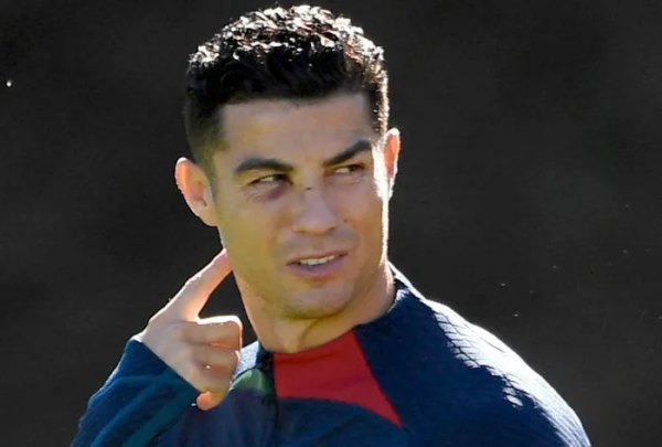 Ronaldo tập luyện với mắt thâm tím