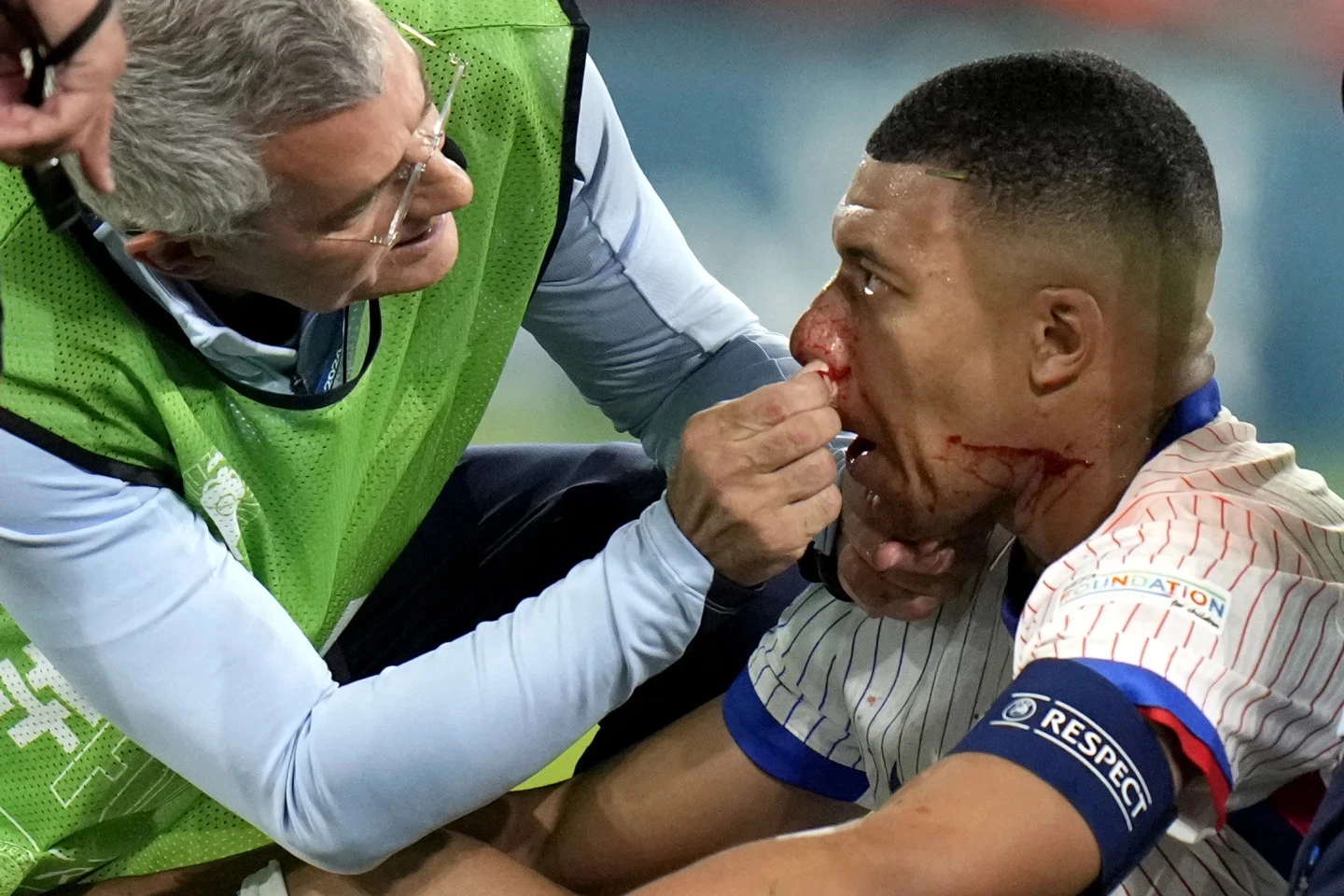 Hình ảnh mới nhất của sao Pháp: ‘Gãy mũi không phải tận thế, Mbappe trở lại rồi đây!’