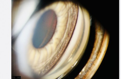 Làm thẻ căn cước buộc thu thập mống mắt: Có khi nào mống mắt bị thay đổi?