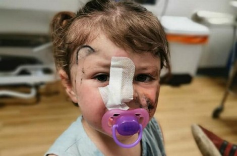 Tham gia sự kiện, bé gái 2 tuổi bị chó cắn suýt mù một bên mắt nhưng phản ứng sau đó của bố mẹ mới khiến nhiều người ngạc nhiên
