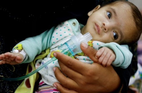 Ám ảnh số phận những đứa trẻ chết dần chết mòn tại Gaza khi nạn đói lan rộng