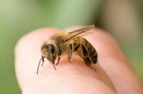 Bé gái 18 tháng tuổi sốc phản vệ sau khi bị ong mật đốt gần 50 nốt