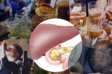 Nguy cơ viêm tuỵ cấp vì lạm dụng rượu bia và chế độ ăn uống không phù hợp