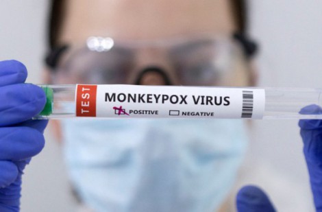 TP Hồ Chí Minh: 8 người tiếp xúc gần ca bệnh mắc đậu mùa khỉ