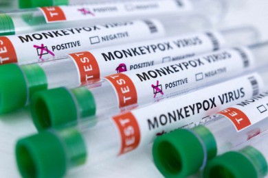 WHO phát hiện virus gây bệnh đậu mùa khỉ trong tinh dịch của bệnh nhân