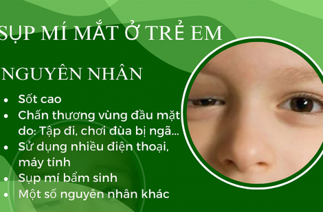 Các phương pháp điều trị sụp mí mắt cho trẻ em an toàn, hiệu quả