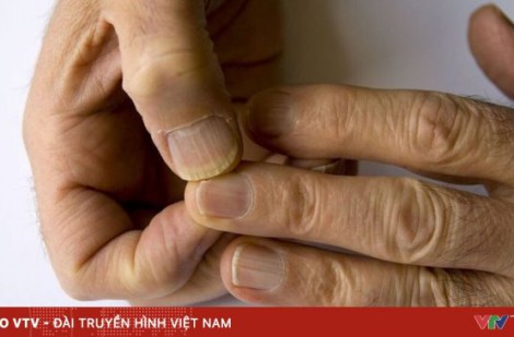 Kiểm tra tốc độ lão hóa qua móng tay