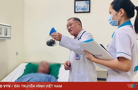 Lấy viên sỏi bàng quang to như quả trứng ngỗng cho bệnh nhân