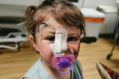 Tham gia sự kiện, bé gái 2 tuổi bị chó cắn suýt mù một bên mắt nhưng phản ứng sau đó của bố mẹ mới khiến nhiều người ngạc nhiên