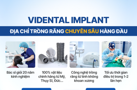 ViDental Implant - Địa chỉ trồng răng chuyên sâu, không đau, an toàn
